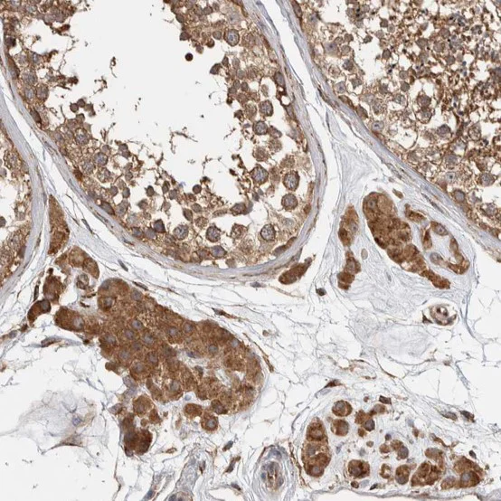 Immunohistochemistry (Formalin/PFA-fixed paraffin-embedded sections) - Anti-EIF3H antibody (AB251743)