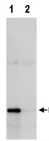 Immunoprecipitation - Anti-eIF3K antibody (AB85968), expandable thumbnail