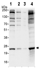 Western blot - Anti-eIF3K antibody (AB85968), expandable thumbnail