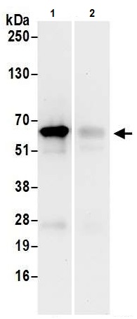 Immunoprecipitation - Anti-eIF3l antibody (AB241367)