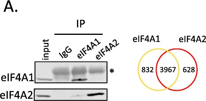 Western blot - Anti-eIF4A1 antibody (AB31217)