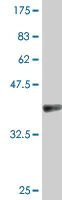 Western blot - Anti-eIF4A2 antibody (AB194471)