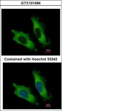 Immunocytochemistry/ Immunofluorescence - Anti-eIF4A2 antibody (AB228693)