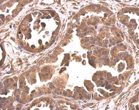 Immunohistochemistry (Formalin/PFA-fixed paraffin-embedded sections) - Anti-eIF4A2 antibody (AB228693)