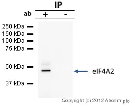 Immunoprecipitation - Anti-eIF4A2 antibody (AB31218)