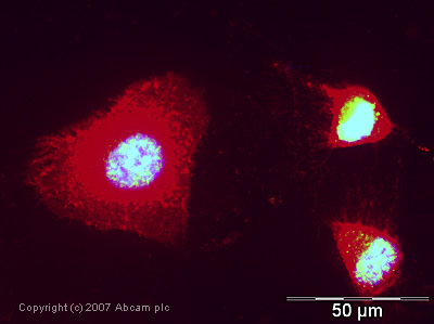 Immunocytochemistry/ Immunofluorescence - Anti-eIF4A3 antibody (AB32485)