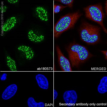 Immunocytochemistry/ Immunofluorescence - Anti-eIF4A3 antibody [EPR14301(B)] (ab180573), expandable thumbnail
