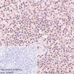 Immunohistochemistry (Formalin/PFA-fixed paraffin-embedded sections) - Anti-eIF4A3 antibody [EPR14301(B)] (AB180573), expandable thumbnail