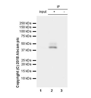 Immunoprecipitation - Anti-eIF4A3 antibody [EPR14301(B)] (AB180573), expandable thumbnail