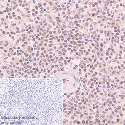 Immunohistochemistry (Formalin/PFA-fixed paraffin-embedded sections) - Anti-eIF4A3 antibody [EPR14301(B)] - BSA and Azide free (AB236131)