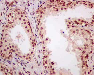 Immunohistochemistry (Formalin/PFA-fixed paraffin-embedded sections) - Anti-eIF4A3 antibody [EPR14301(B)] - BSA and Azide free (AB236131), expandable thumbnail