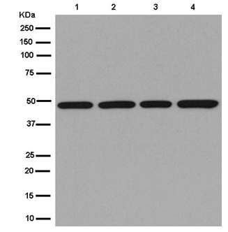 Western blot - Anti-eIF4A3 antibody [EPR14302(B)] - BSA and Azide free (AB250217), expandable thumbnail