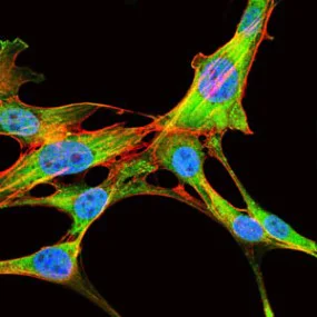 Immunocytochemistry/ Immunofluorescence - Anti-eIF4B antibody [1F5] (AB129369)