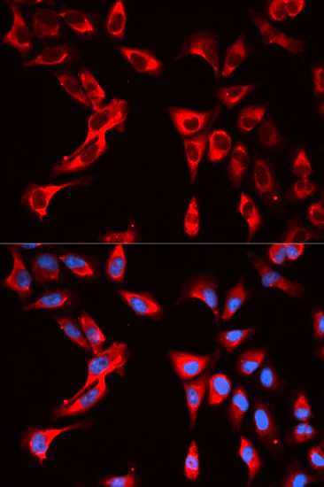 Immunocytochemistry/ Immunofluorescence - Anti-eIF4B antibody (AB186856)
