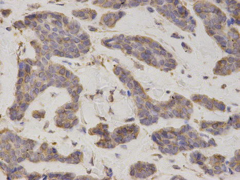 Immunohistochemistry (Formalin/PFA-fixed paraffin-embedded sections) - Anti-eIF4B antibody (AB186856)