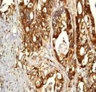 Immunohistochemistry (Formalin/PFA-fixed paraffin-embedded sections) - Anti-eIF4B antibody [EP2299Y] - BSA and Azide free (AB284714), expandable thumbnail
