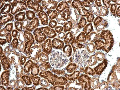 Immunohistochemistry (Formalin/PFA-fixed paraffin-embedded sections) - Anti-eIF4B antibody - N-terminal (AB228800)