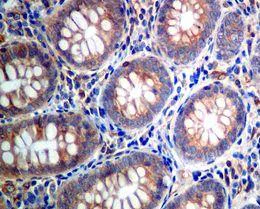 Immunohistochemistry (Formalin/PFA-fixed paraffin-embedded sections) - Anti-eIF4B (phospho S406) antibody [EPR7683] - BSA and Azide free (AB248698)