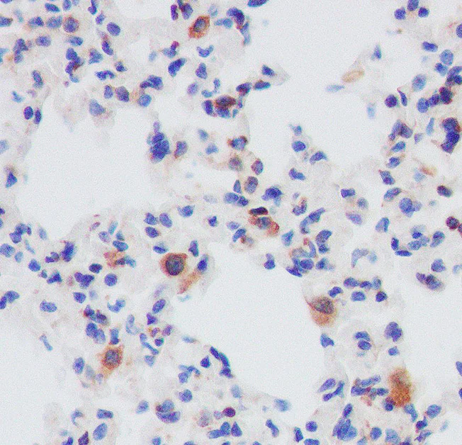 Immunohistochemistry (Formalin/PFA-fixed paraffin-embedded sections) - Anti-eIF4B (phospho S406) antibody [SR2202] (AB326668)