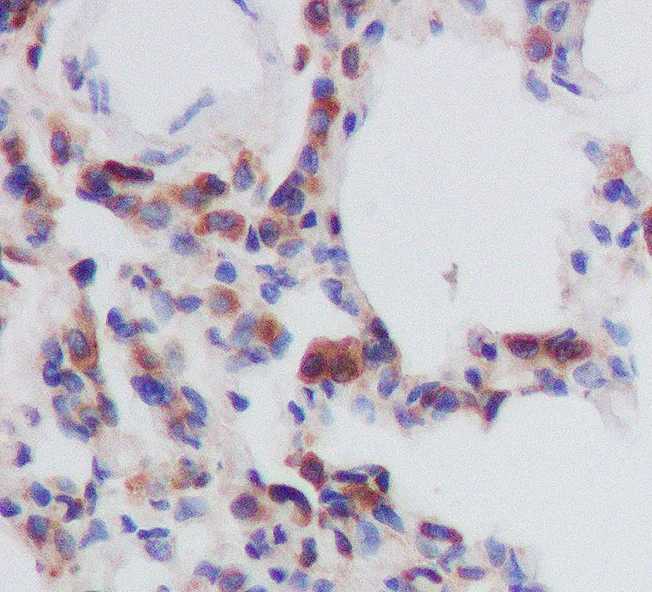 Immunohistochemistry (Formalin/PFA-fixed paraffin-embedded sections) - Anti-eIF4B (phospho S406) antibody [SR2202] (AB326668)