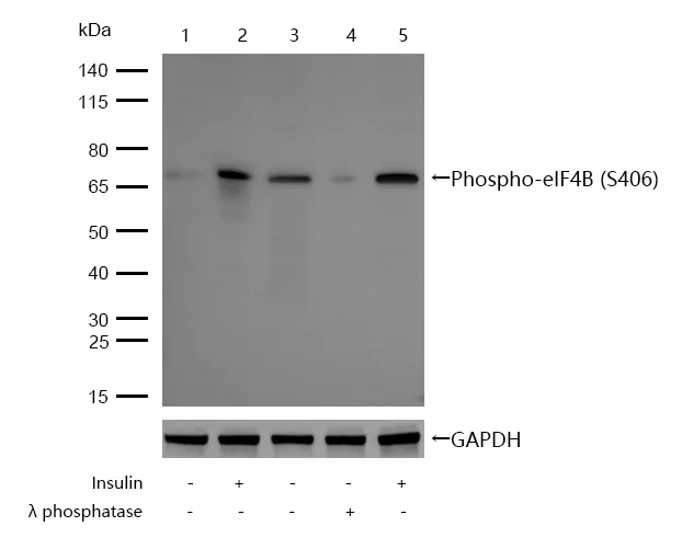 Western blot - Anti-eIF4B (phospho S406) antibody [SR2202] (AB326668)