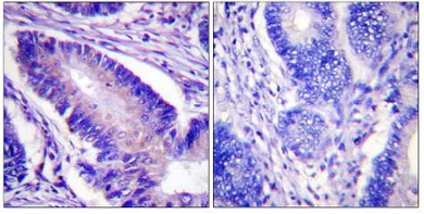 Immunohistochemistry (Formalin/PFA-fixed paraffin-embedded sections) - Anti-eIF4B (phospho S422) antibody (AB59300)