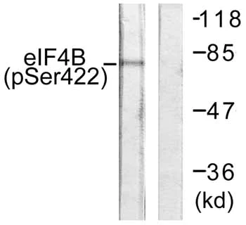 Western blot - Anti-eIF4B (phospho S422) antibody (AB59300)