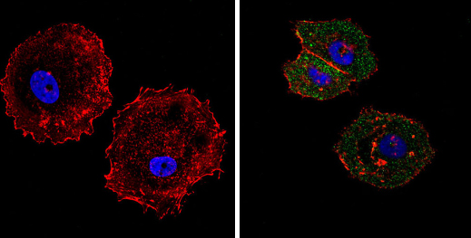 Immunocytochemistry/ Immunofluorescence - Anti-eIF4E antibody [5D11] (AB171091), expandable thumbnail