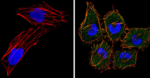 Immunocytochemistry/ Immunofluorescence - Anti-eIF4E antibody [5D11] (AB171091), expandable thumbnail