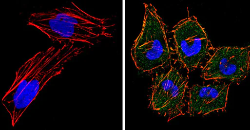 Immunocytochemistry/ Immunofluorescence - Anti-eIF4E antibody [5D11] (AB171091)
