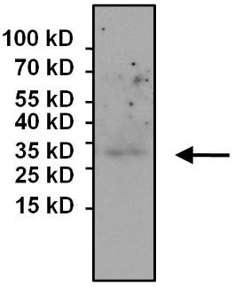 Immunoprecipitation - Anti-eIF4E antibody [5D11] (AB171091), expandable thumbnail