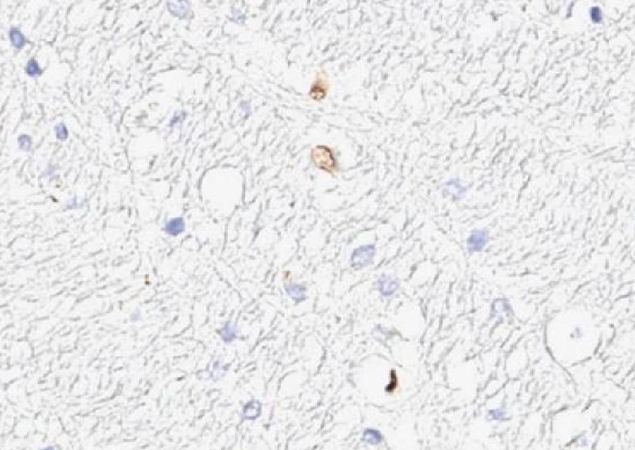 Immunohistochemistry (Formalin/PFA-fixed paraffin-embedded sections) - Anti-eIF4E antibody (AB235191)
