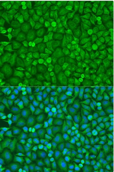 Immunocytochemistry/ Immunofluorescence - Anti-eIF4E antibody (AB238519)