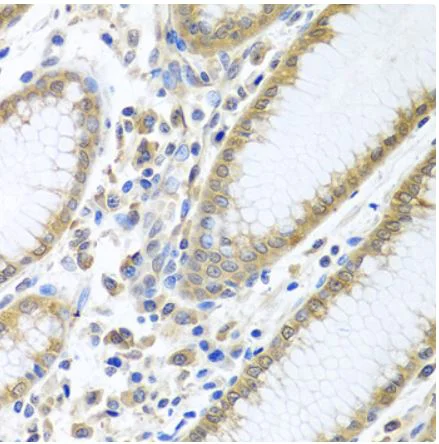 Immunohistochemistry (Formalin/PFA-fixed paraffin-embedded sections) - Anti-eIF4E antibody (AB238519)
