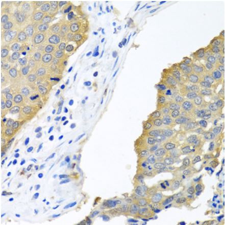 Immunohistochemistry (Formalin/PFA-fixed paraffin-embedded sections) - Anti-eIF4E antibody (AB238519)