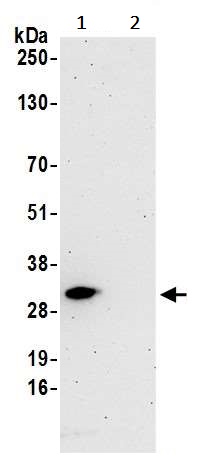Immunoprecipitation - Anti-eIF4E antibody (AB245299)