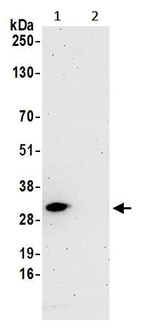 Immunoprecipitation - Anti-eIF4E antibody (AB245299)