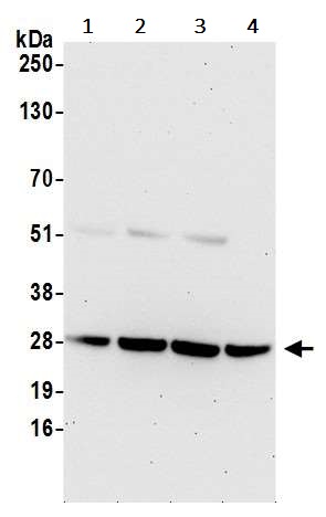 Western blot - Anti-eIF4E antibody (AB245299)