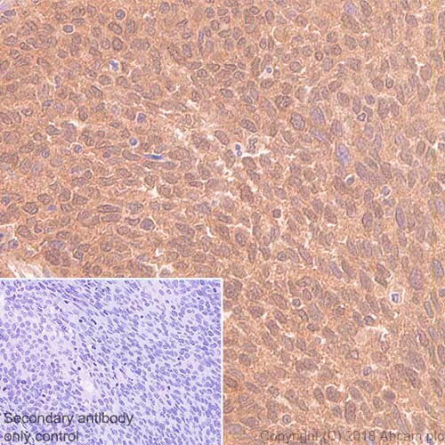 Immunohistochemistry (Formalin/PFA-fixed paraffin-embedded sections) - Anti-eIF4E antibody [Y448] (AB33766)