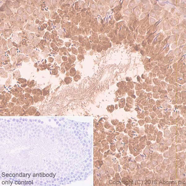 Immunohistochemistry (Formalin/PFA-fixed paraffin-embedded sections) - Anti-eIF4E antibody [Y449] (ab33768), expandable thumbnail
