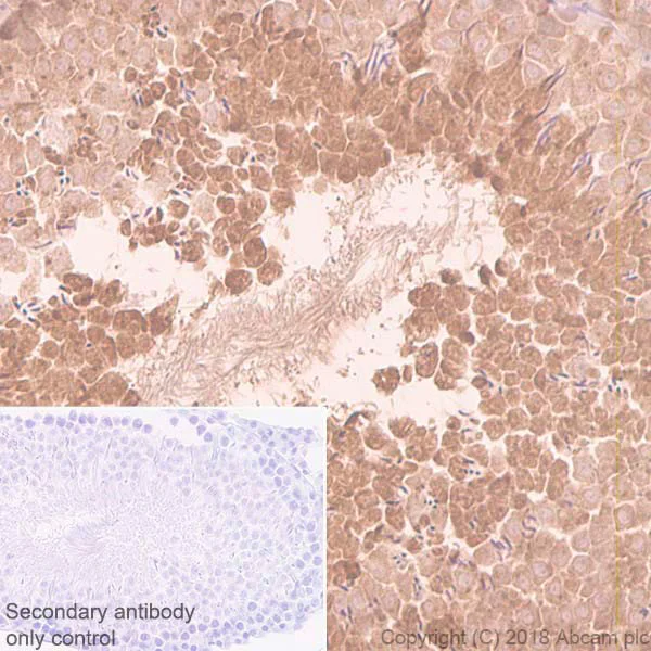 Immunohistochemistry (Formalin/PFA-fixed paraffin-embedded sections) - Anti-eIF4E antibody [Y449] (AB33768)