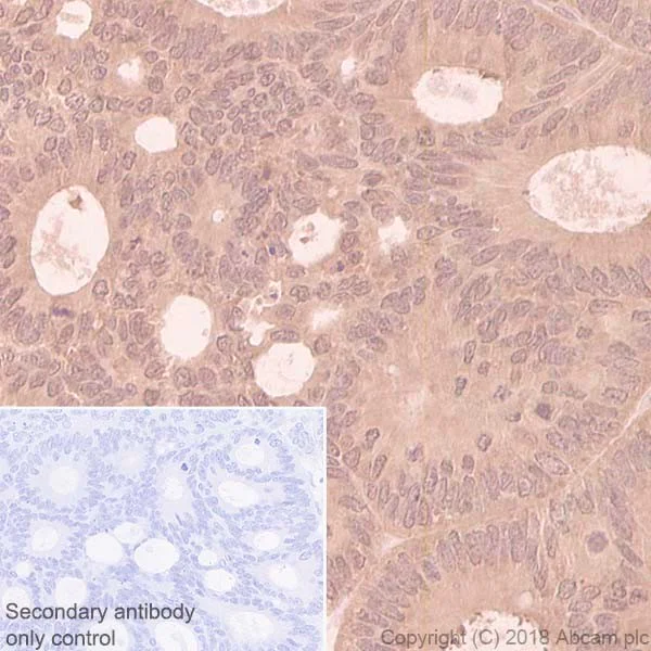 Immunohistochemistry (Formalin/PFA-fixed paraffin-embedded sections) - Anti-eIF4E antibody [Y449] (AB33768)