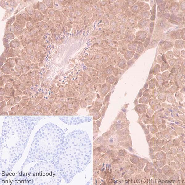Immunohistochemistry (Formalin/PFA-fixed paraffin-embedded sections) - Anti-eIF4E antibody [Y449] (ab33768), expandable thumbnail
