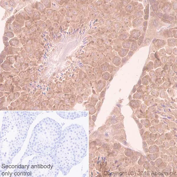 Immunohistochemistry (Formalin/PFA-fixed paraffin-embedded sections) - Anti-eIF4E antibody [Y449] (AB33768)