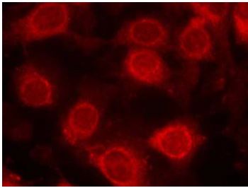 Immunocytochemistry/ Immunofluorescence - Anti-eIF4E (phospho S209) antibody (AB131513)