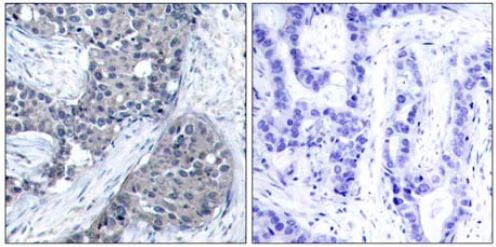 Immunohistochemistry (Formalin/PFA-fixed paraffin-embedded sections) - Anti-eIF4E (phospho S209) antibody (AB131513)
