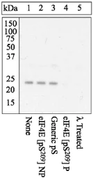 Western blot - Anti-eIF4E (phospho S209) antibody (AB4774)