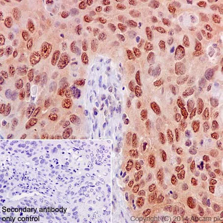 Immunohistochemistry (Formalin/PFA-fixed paraffin-embedded sections) - Anti-eIF4E (phospho S209) antibody [EP2151Y] (AB76256)