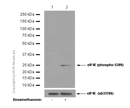 Western blot - Anti-eIF4E (phospho S209) antibody [EP2151Y] (AB76256)
