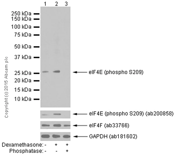 Western blot - Anti-eIF4E (phospho S209) antibody [EP2151Y] (AB76256)